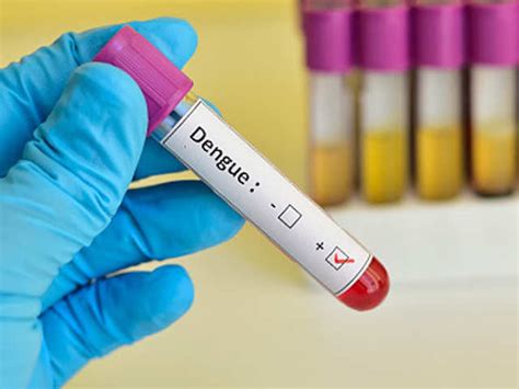dengue blood test cost